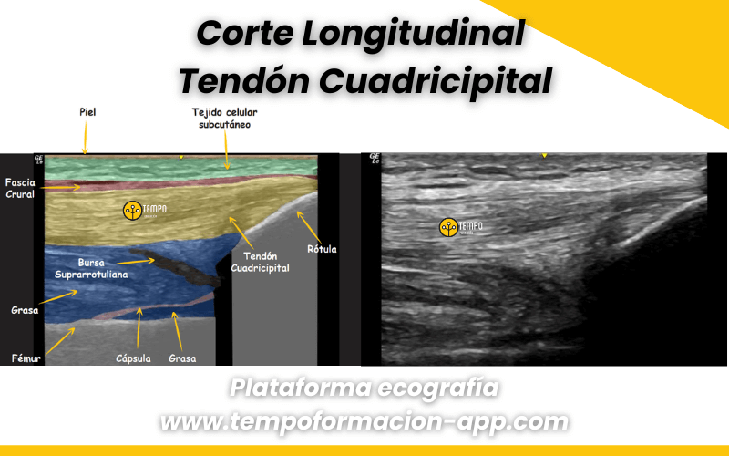 4. Ecografia tempo formacion rodilla.png